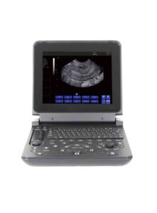 BM – U12 Digital Diagnostic  Ultrasound System